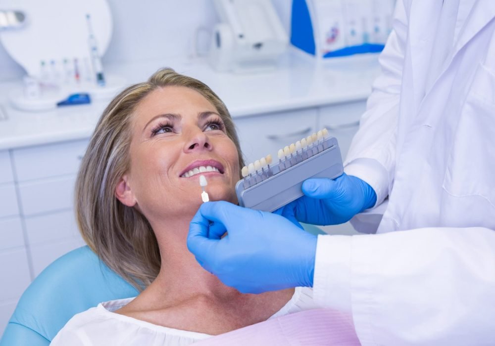 Blanqueamiento dental profesional Blanqueamiento dental profesional